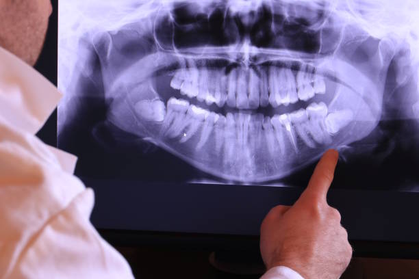 Best Emergency Tooth Extraction in Tuckahoe, VA