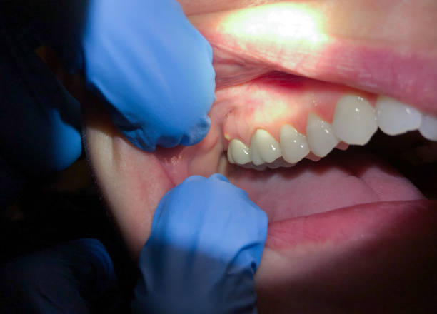Best Same-Day Emergency Dentist in Tuckahoe, VA