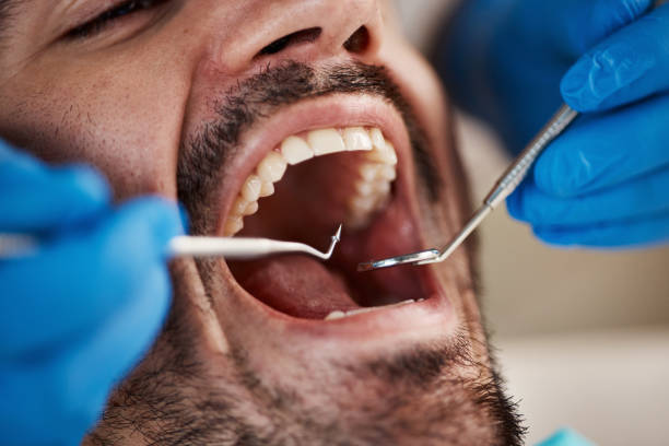 Best Walk-In Emergency Dentist in Tuckahoe, VA